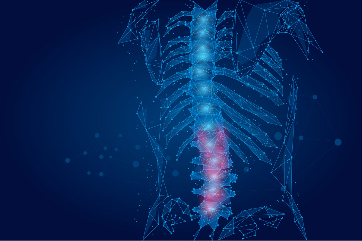 פענוח MRI עמוד שדרה מותני