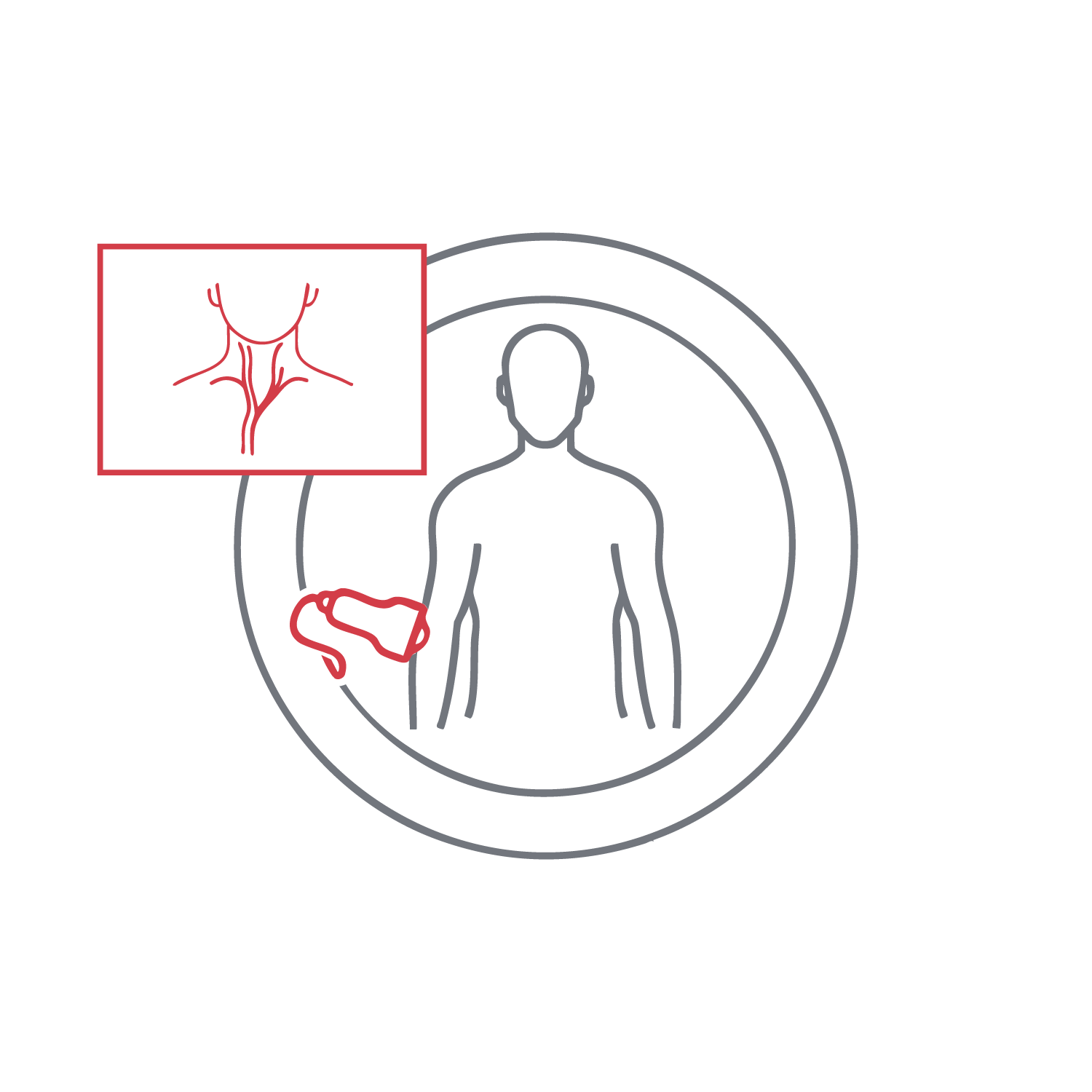 אולטרסאונד דופלר עורקי צוואר (Carotid Doppler)