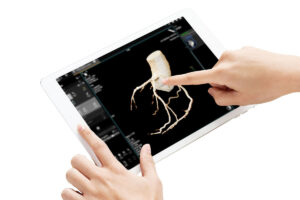 CT לב, בדיקת סיטי לב